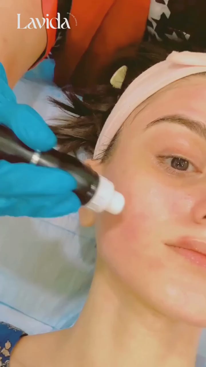 Lavida Vitamin C + Hyaluronic Acid